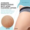 Ayadara Butt Acne Clearing Lotion | Pimple & Zit Prevention Booty Cream with Salicylic Acid & Tea Tree | Moisturizing Cystic Acne Treatment for Buttocks | Women, Men, Teens, & Adults | 90-Day Supply