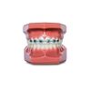 Braces Wax Alternative Bracket Cover Bumper Orthodontic Braces Accessories Snapcaps Butterfly 10 Ct.