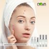 Acne Kit 6 Products By Nova Skin
