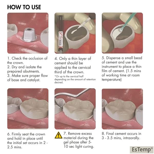 Permanent Dental Cement for Caps, Crowns, Bridges, Inlays, Onlays, Implants, Veneers ESTEMP