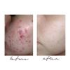 First Lady Papaya Clear Complexion Lightenizer Soap 200g - Lightening & Exfoliating