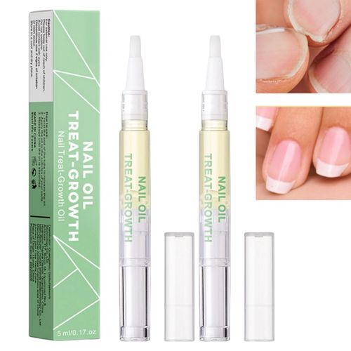 2PCS Radiant Nail Growth Oil,Cuticle Oil for Nail,Radiant Nail Growth Oil Pen,Nail Growth Oil,Rejuvenation Nail Growth Oil,Nail Strengthener,Nail Nutrition Pen for Moisturize Dry Nails & Cuticles Care