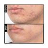 pH-In The Moisture Treatment