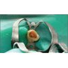 SURGICAL ONLINE 3 Endodontic Rubber Dam Clamps # 211
