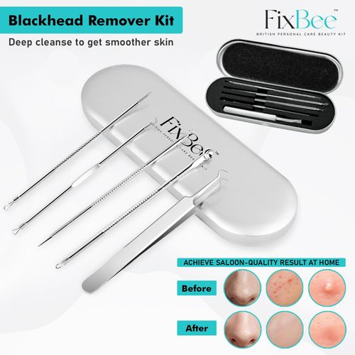 Blackhead Remover Tool - Pimple Popping Kit with Blackhead Tweezer - Milia Remover, Pimple Popper, Black Head Remove Tool Set with Facial Blackhead Remover Tweezers - 5PC Spot Popping Kit