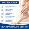 UREA LT 10% 8OZ TOP by UREA