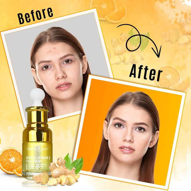 GINGER FACE BRIGHTNING SERUM, VITAMIN C + DARK SPOT CORRECTOR, REMOVE ACNE