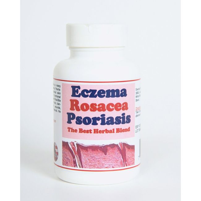 ECZEMA ROSACEA & PSORIASIS FIGHT - Prevent and Treat - 100% Natural