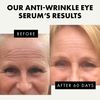 Retinol Under Eye Serum for Dark Circles and Puffiness - Anti Aging Eye Cream with Caffeine, Collagen, Vitamin C+E, Under Eye Serum Wrinkle Cream, Eye Care, Eye Treatment Products, Dark Circle Remover