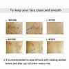7pcs Blackhead Acne Comedone Pimple Blemish Extractor Remover Tool Kit Set