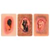 MedEduQuest Necrotic Wound Packing Trainer, Palm-Sized Wound Model, 3PCS