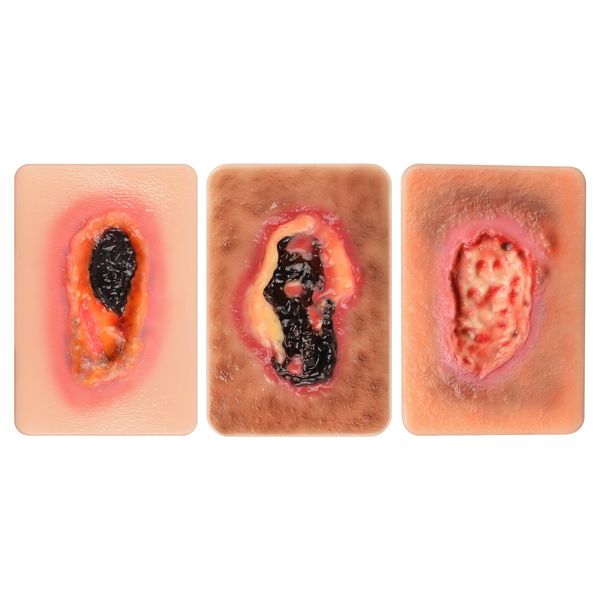 MedEduQuest Necrotic Wound Packing Trainer, Palm-Sized Wound Model, 3PCS