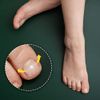 [Korean Intellectual Property Office Utility Model Patent] Perfecto Ingrown toenail brace self-healing tape correction set, 24mm strip