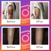 Foundation Tape (Conceals Dark Scars), 10 Pieces, Tan Ochre, Conceals Wrist Cutting Scars, Waterproof, Matte, Skin Tone Sheets, Made in Japan, Login My Life, Patented
