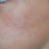 Hydration Refinement Facial Scrub -  Youmans Touch Wellness