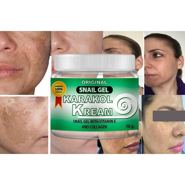 Karakol-kream cream acne gel dark spots skincare face hands moisture