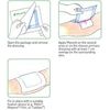 Mesorb Dressing 15cm x 20cm (x10)