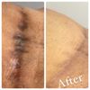 Body Bleaching Cream Max Strength Whitening Lightening AHA