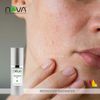 Sensitive Gel Serum By Nova Skin