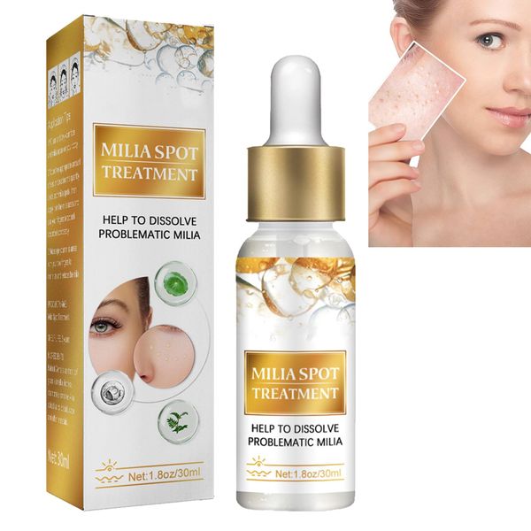 Milia Removal Face Serums,Milia Spot Remover,Milia Remover,Milia Spot Serum for Face,Milia Serum for Face,Milia Spot Serum Helps to Ruduce Milia,Reduces Bags,Saggy Skin & Puffy Eyes 30ML