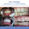 Kit de Gel Blanqueador de Dientes Crystal Clear con luz LED