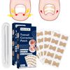 100PCS Ingrown Toenail Corrector, Toenail Correction Tool