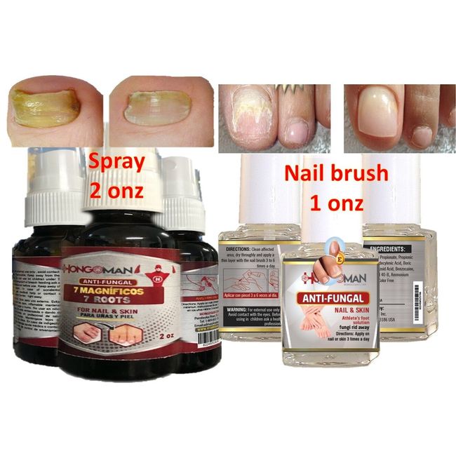 Anti fungus support  nails feet set to clear fungus nail fungus