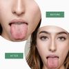 QD Essential Tongue Scraper with Travel Case (Two Pack)| Prevent Bad Breath with Easy To Carry Tongue Cleaner |100% Stainless Steel Tongue Scrubber for Daily Hygiene & Oral Care