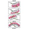 Microtec X Floss x 1 Box, Set of 30
