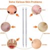 2pcs Acne Needle Removal Kit  Whitehead & Blackhead Remover, Pimple Extractor