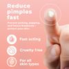 PatchRx Micro Needle Pimple Patch (18 Pack) - Hydrocolloid Micropoint Pimple Patch For Acne & Pimples, Eliminate Pimples Overnight, Microdart Patch, Micro Dart Pimple Patches