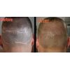 HD-C - SMP Scalp pigment - 1 Oz