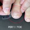 [Intellectual Property Office utility model medical device] Perfecto ingrown toenail straightener self-healing tape correction set, 1 set