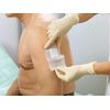 Cosmopor-E Sterile Adhesive Wound Dressing, 15 x 8 cm
