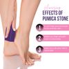 Glamza Foot Pumice Sponge Callus Exfoliate Stone Hard Skin Remove Pedicure Scrubber Pack of 4