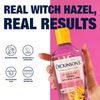 Dickinson's Enhanced Witch Hazel Hydrating Toner with Rosewater, Alcohol Free, 98% Natural Formula, 16 Fl Oz