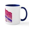 CafePress Stomach Lining, Light Micrograph Mug 11 oz (325 ml) Ceramic Coffee Mug