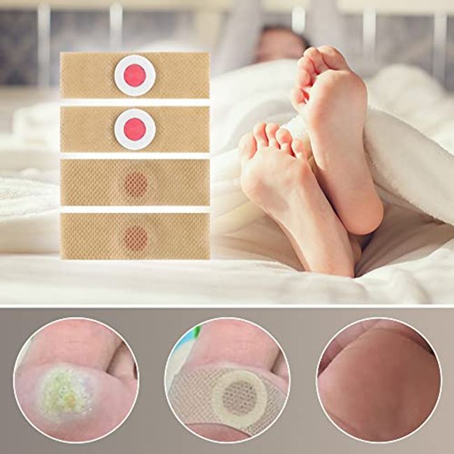 50 Pcs Foot Corn Remover Pads Plantar Wart Thorn Plaster Patch Callus  Removal