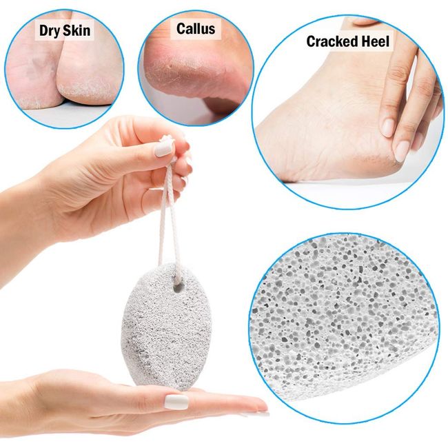 Pumice Stone For Feet 2 Pcs Set Foot Care Natural Stones For Dead Hard Skin  Foot Scrubber Removes Gently Exfoliates Skin Softer Smoother Heels Beauty