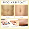 Banana Serum, Activate Fat Burning, 1 fl oz