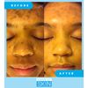 Admire My Skin Dark Spot Corrector Remover for Face - Brightening Discoloration Correcting Serum - Melasma Treatment Cream with Synovea, Kojic Acid, Vitamin C, Salicylic Acid, Lactic Acid Serum