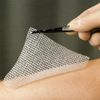Lomatuell H Ointment Tulle 5 x 5 cm