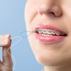 VINSULLA Floss Threaders for Braces, Bridges, and Implants 400 Count (Pack of 8)