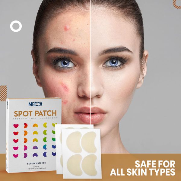 MEDca Acne Care Pimple Patch - 8 - Cheek Size Acne Spot Treatment Hydrocolloid Bandage Absorbing Cover for Face Skin Acne Spot Patch Conceals, Reduces Pimples and Blackheads