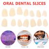 EXCEART Teeth Veneer 100 Pieces Artificial Resin Tooth Fillings Temporary Veneer Tooth Replacements Tooth Repair Supply