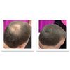 Caboki Hair Loss Concealer 25g Medium Brown
