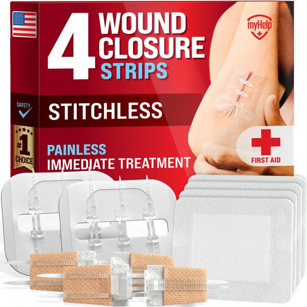 Emergency Wound Closure Strips - 4pk - 2 Types Laceration Closure Kit - Stitchless & Easy to Use - Butterfly Bandages