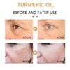 2Pack Turmeric Dark Spot Corrector Serum, Natural Turmeric Repair Face Serum for Face Melasma, Hydrate Dull and Dry Skin
