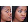 Bio Fair Anti-Blotching & Brightening Face Cream | 50ml