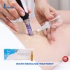 Caffeine Plus By DeNova Mesotherapy